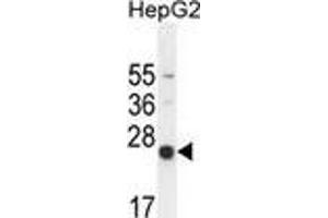 Image no. 2 for anti-Nudix (Nucleoside Diphosphate Linked Moiety X)-Type Motif 15 (NUDT15) (AA 89-118), (C-Term) antibody (ABIN953779)
