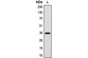 Image no. 3 for anti-Apoptotic Peptidase Activating Factor 1 (APAF1) (C-Term) antibody (ABIN2704483)