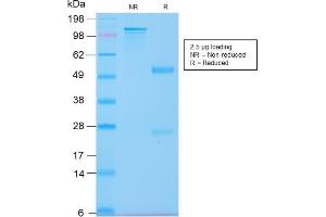 Image no. 4 for anti-Keratin 20 (KRT20) (AA 196-323) antibody (ABIN6940352)