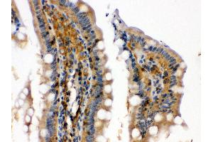 Anti- RAB13 Picoband antibody, IHC(P) IHC(P): Rat Intestine Tissue