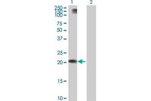 Image no. 2 for anti-Apolipoprotein L, 1 (APOL1) (AA 1-238) antibody (ABIN521983)
