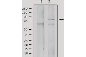 Image no. 3 for anti-Adrenergic, Beta, Receptor Kinase 2 (ADRBK2) antibody (ABIN6256967)