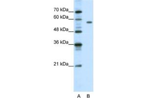 Image no. 1 for anti-Pre-B-Cell Leukemia Homeobox Protein 2 (PBX2) antibody (ABIN2461667)