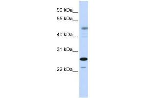 Image no. 1 for anti-PSMC3 Interacting Protein (PSMC3IP) (C-Term) antibody (ABIN928182)