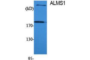 Image no. 1 for anti-Alstrom Syndrome 1 (ALMS1) (Internal Region) antibody (ABIN3183254)