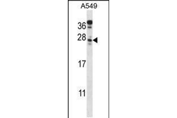 anti-Chromosome 4 Open Reading Frame 49 (C4orf49) (AA 176-204), (C-Term) antibody