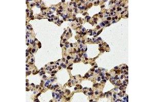 Image no. 2 for anti-T-Box 5 (TBX5) antibody (ABIN2966725)