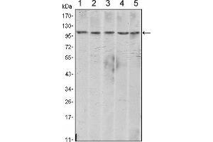 Image no. 5 for anti-Cadherin 2 (CDH2) antibody (ABIN969038)