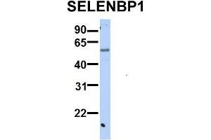 Image no. 5 for anti-Selenium Binding Protein 1 (SELENBP1) (C-Term) antibody (ABIN2783295)