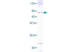 Image no. 1 for Bone Morphogenetic Protein 7 (BMP7) (AA 1-431) protein (GST tag) (ABIN1346771)