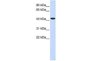 BACE1 antibody used at 1 ug/ml to detect target protein.