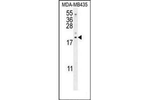 Image no. 3 for anti-LYR Motif Containing 4 (LYRM4) (AA 46-73), (Middle Region) antibody (ABIN953261)