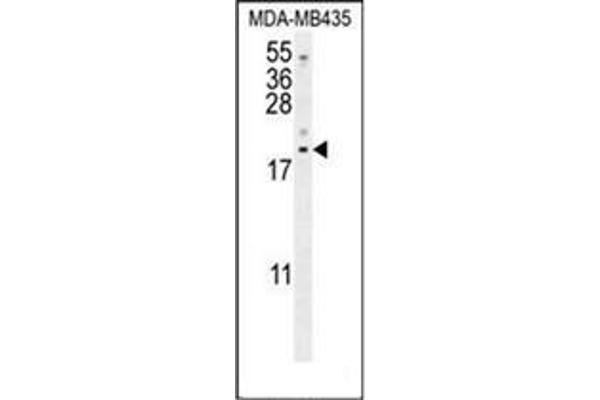 LYRM4 antibody  (Middle Region)