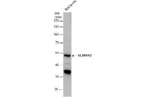 Image no. 2 for anti-Aldehyde Dehydrogenase 1 Family, Member A2 (ALDH1A2) (Center) antibody (ABIN2856988)