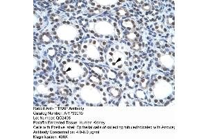 TDP2 antibody  (Middle Region)