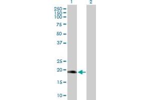Image no. 1 for anti-Distal-Less Homeobox 6 (DLX6) (AA 1-175) antibody (ABIN515024)