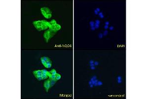 Image no. 1 for anti-NAD(P)H Dehydrogenase, Quinone 1 (NQO1) (C-Term) antibody (ABIN184714)