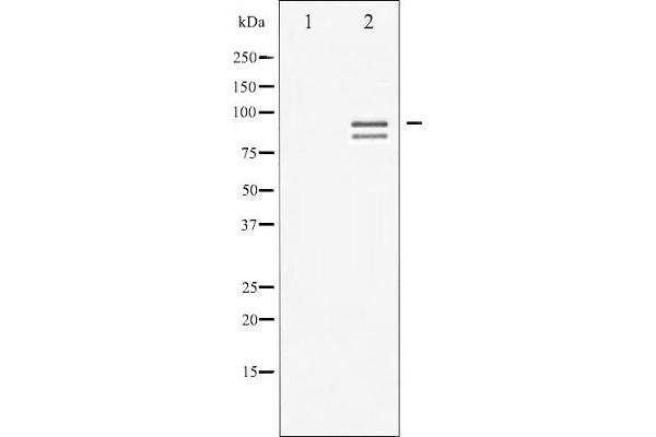 Glycogen Synthase 1 Antikörper  (pSer645)
