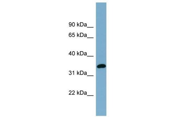anti-Acyl-CoA Wax Alcohol Acyltransferase 1 (AWAT1) (N-Term) antibody