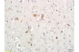 Formalin-fixed and paraffin embedded rat brain labeled with Anti-Persephin Polyoclonal Antibody, Unconjugated (ABIN687667) followed by conjugation to the secondary antibody and DAB staining