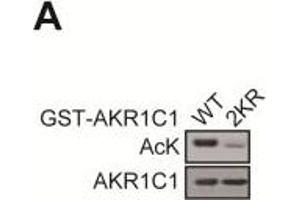 Image no. 8 for anti-Dihydrodiol Dehydrogenase (DDH) (Center) antibody (ABIN2856139)