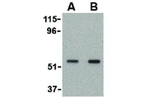 Image no. 3 for anti-SKI-Like Oncogene (SKIL) (N-Term) antibody (ABIN6656781)
