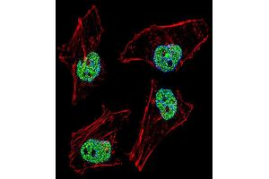 Image no. 2 for anti-Nuclear Transcription Factor Y, beta (NFYB) (AA 17-46), (N-Term) antibody (ABIN5531696)