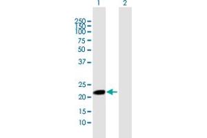 Image no. 1 for anti-Myosin, Light Chain 5, Regulatory (MYL5) (AA 1-173) antibody (ABIN518154)