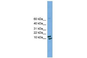 Image no. 2 for anti-Peptidylprolyl Isomerase H (Cyclophilin H) (PPIH) (Middle Region) antibody (ABIN2784802)