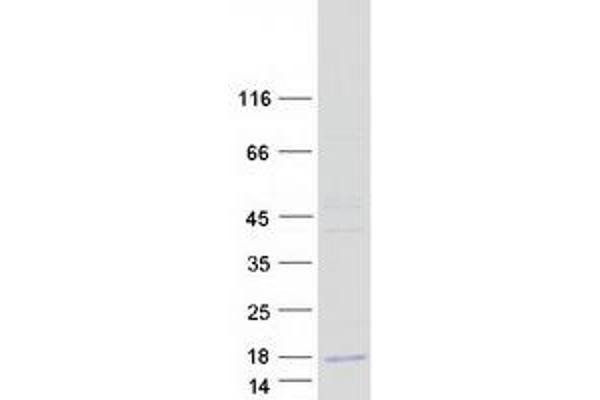Otoraplin Protein (OTOR) (Myc-DYKDDDDK Tag)