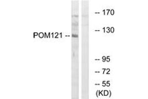 Image no. 1 for anti-POM121 Membrane Glycoprotein (POM121) (AA 1197-1246) antibody (ABIN1535113)