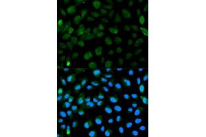 Image no. 1 for anti-Promyelocytic Leukemia (PML) antibody (ABIN3021659)