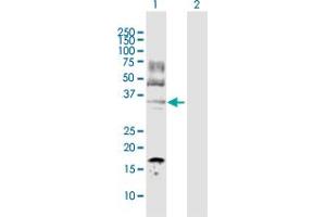 Image no. 2 for anti-Lactate Dehydrogenase C (LDHC) (AA 1-332) antibody (ABIN517462)