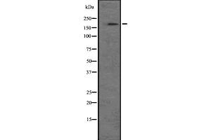 Western blot analysis of NRK expression in A549 cell line lysate ;,The lane on the left is treated with the antigen-specific peptide.