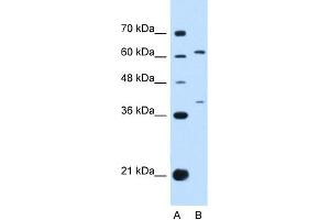 Image no. 1 for anti-Interleukin 28 Receptor, alpha (Interferon, lambda Receptor) (IL28RA) (N-Term) antibody (ABIN2783215)