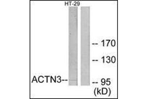 Image no. 2 for anti-Actinin, alpha 3 (ACTN3) (N-Term) antibody (ABIN615863)