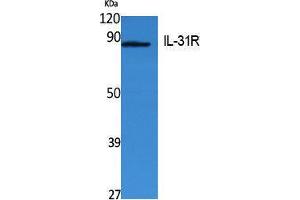 Image no. 1 for anti-Interleukin 31 Receptor A (IL31RA) (Internal Region) antibody (ABIN3180977)