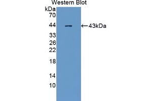 Image no. 1 for anti-Ubiquitin Specific Peptidase 8 (USP8) (AA 777-1118) antibody (ABIN1872156)