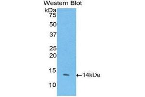 Image no. 1 for anti-Coagulation Factor VII (F7) (AA 334-452) antibody (ABIN1175149)