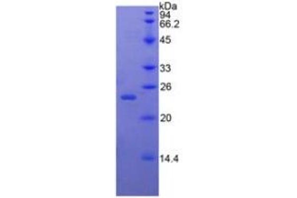 Bone Morphogenetic Protein 4 (BMP4) ELISA Kit
