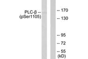 Western blot analysis of extracts from A431 cells, using PLCB3 (Phospho-Ser1105) Antibody.