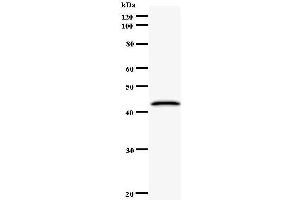 Image no. 1 for anti-CCR4-NOT Transcription Complex, Subunit 6 (CNOT6) antibody (ABIN932464)