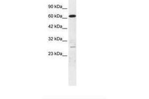 Image no. 2 for anti-Mediator Complex Subunit 17 (MED17) (AA 156-205) antibody (ABIN6735876)