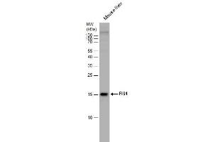 WB Image FIS1 antibody detects FIS1 protein by western blot analysis.