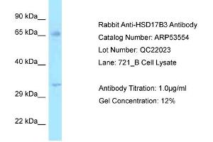 Image no. 1 for anti-Hydroxysteroid (17-Beta) Dehydrogenase 3 (HSD17B3) (N-Term) antibody (ABIN2785439)
