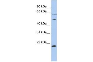 Image no. 1 for anti-Proteasome (Prosome, Macropain) 26S Subunit, ATPase, 2 (PSMC2) (N-Term) antibody (ABIN2778346)