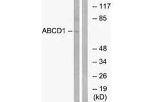Image no. 1 for anti-ATP-Binding Cassette, Sub-Family D (Ald), Member 1 (ABCD1) (AA 531-580) antibody (ABIN1534673)