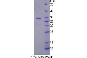 Image no. 1 for Cathepsin A (CTSA) (AA 171-417) protein (His tag) (ABIN6238370)