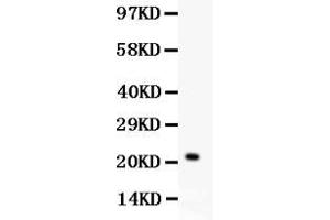 Image no. 2 for anti-Interleukin 18 (IL18) (AA 175-193), (C-Term) antibody (ABIN3042624)
