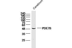 Image no. 3 for anti-phosphodiesterase 7B (PDE7B) (AA 281-360) antibody (ABIN1386171)